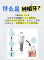 香港邊間醫院的種植牙效果好?深圳博愛曙光醫院提供個性化方案